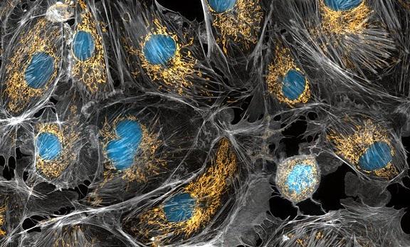 Mitocondria aurie furnizează organelelor puterea de a funcționa